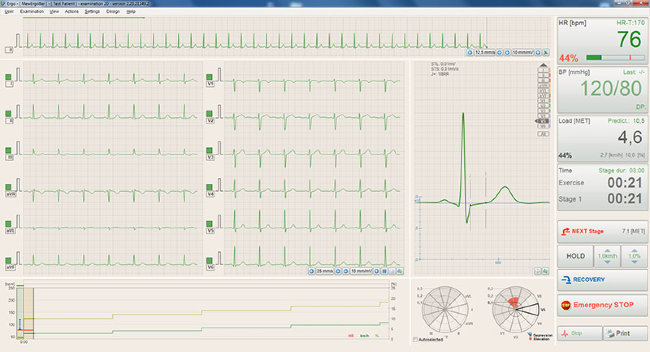 Электрокардиограф BTL-08 SD3 CardioPoint-ECG C600 с принадлежностями