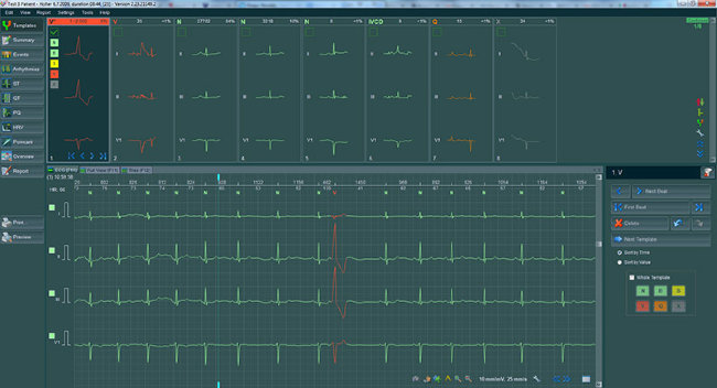 Электрокардиограф BTL CardioPoint-Holter H100 с принадлежностями Электрокардиограф BTL CardioPoint-Holter H100 с принадлежностями