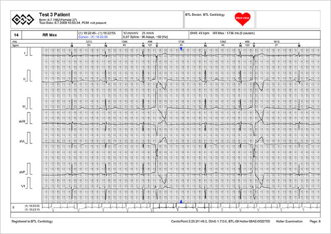 Электрокардиограф BTL CardioPoint-Holter H300 с принадлежностями Электрокардиограф BTL CardioPoint-Holter H300 с принадлежностями